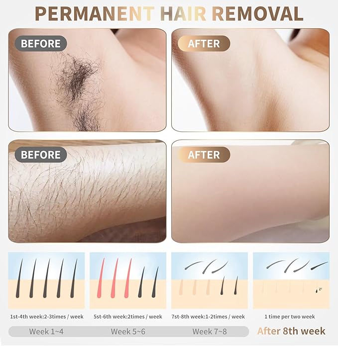 Mini Laser Hair Removal Device (5 Lac Flashes) with Replacement Warranty