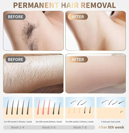 Mini Laser Hair Removal Device With Warranty