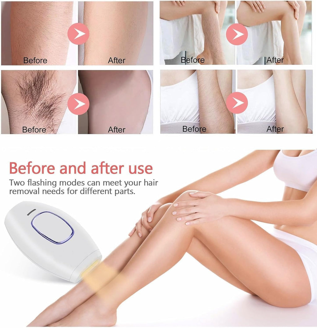 Mini Laser Hair Removal Device (5 Lac Flashes) with Replacement Warranty