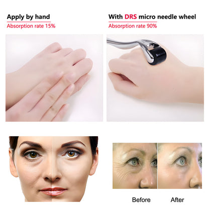 Microneedling Tool (100% Original Titanium 540 Microneedles) + FREE Vitamin C Serum (Premium & Organic)