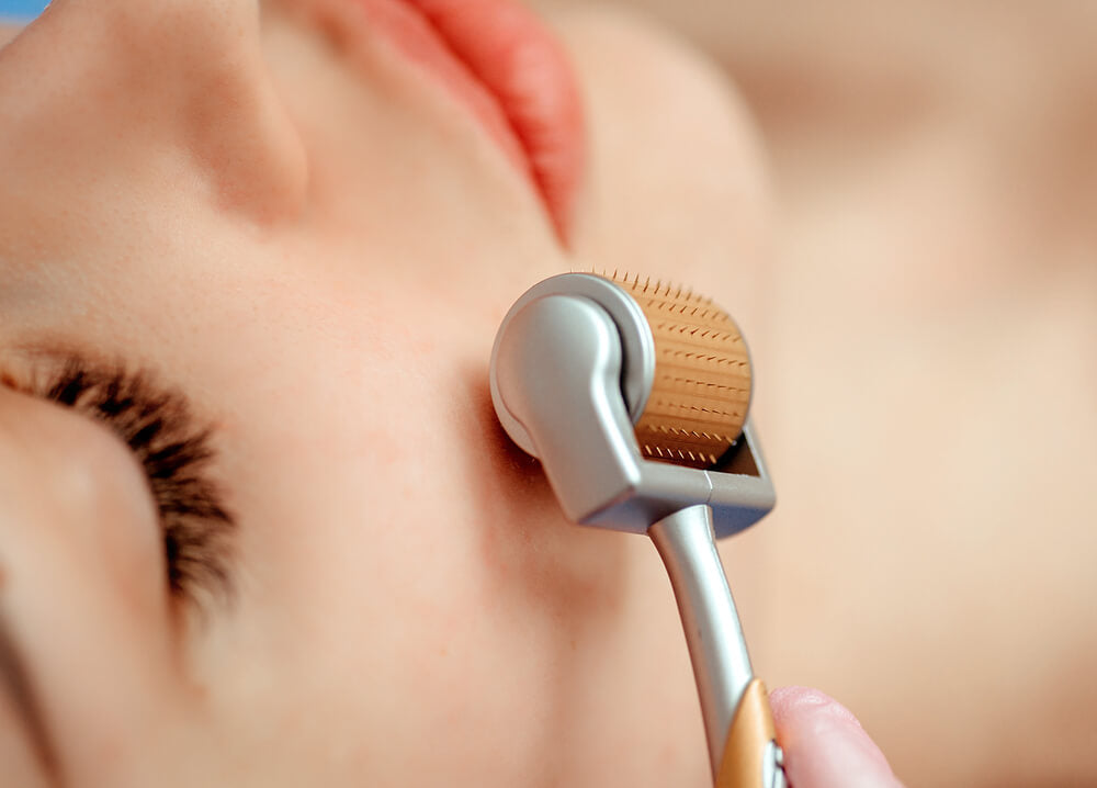 Microneedling Tool (100% Original Titanium 540 Microneedles) + FREE Vitamin C Serum (Premium & Organic)