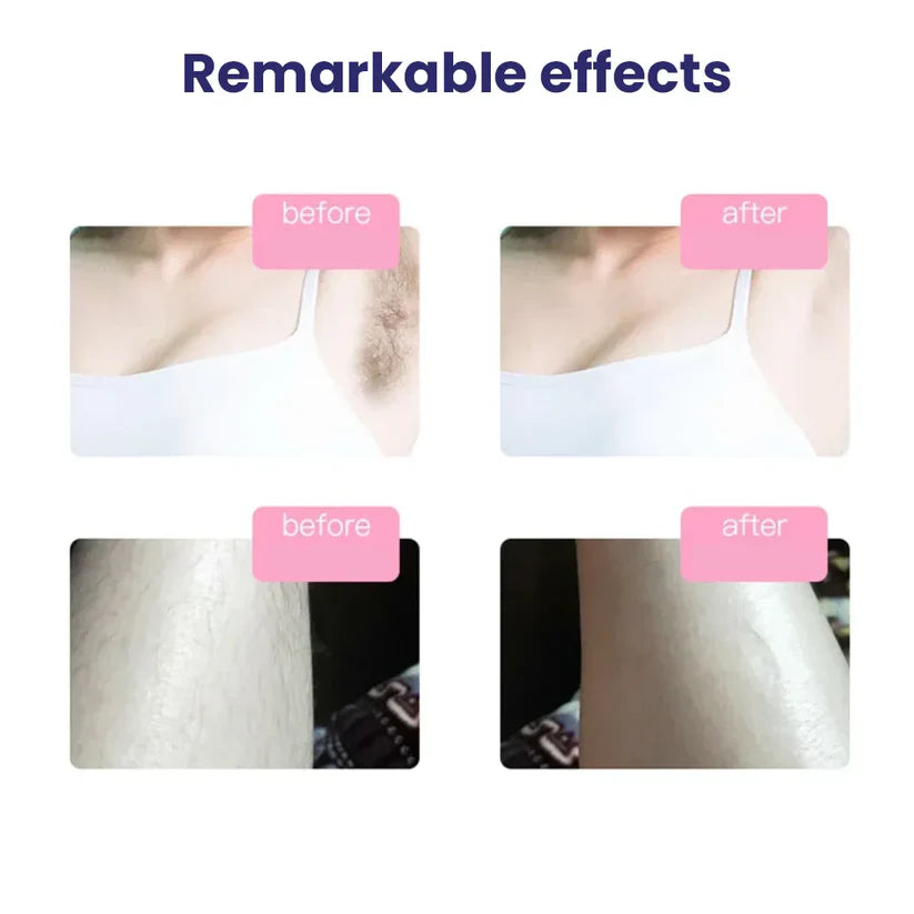 Laser Hair Removal Device Auto Mode With Warranty