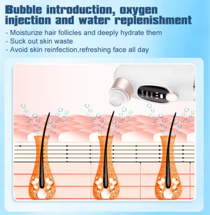 Mini Hydra Facial Device with FREE Serum + Replacement Warranty